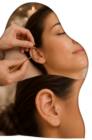 Auriculoterapia