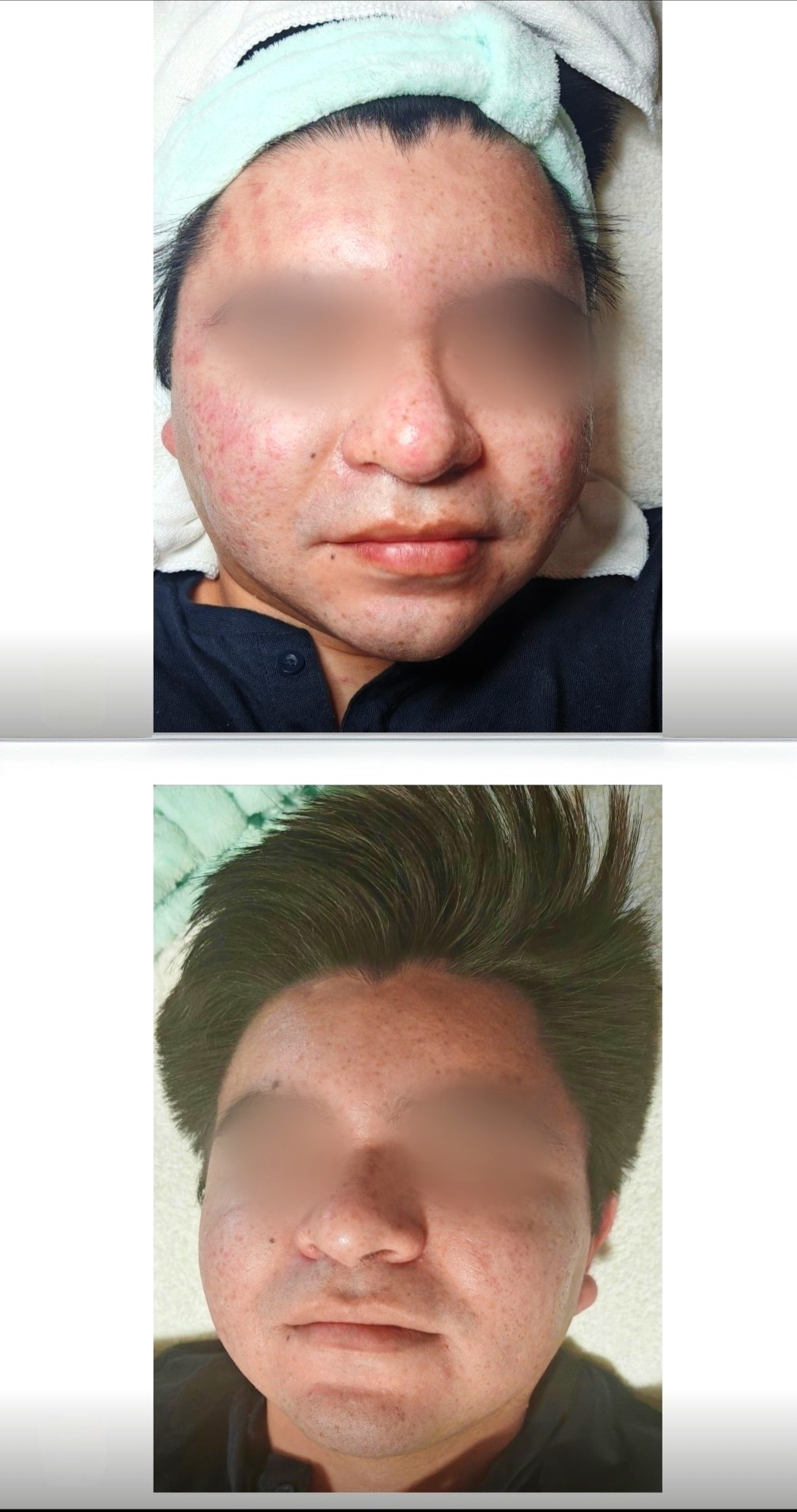 Proceso de cuidado facial compartido por una persona cliente de Shen Balance