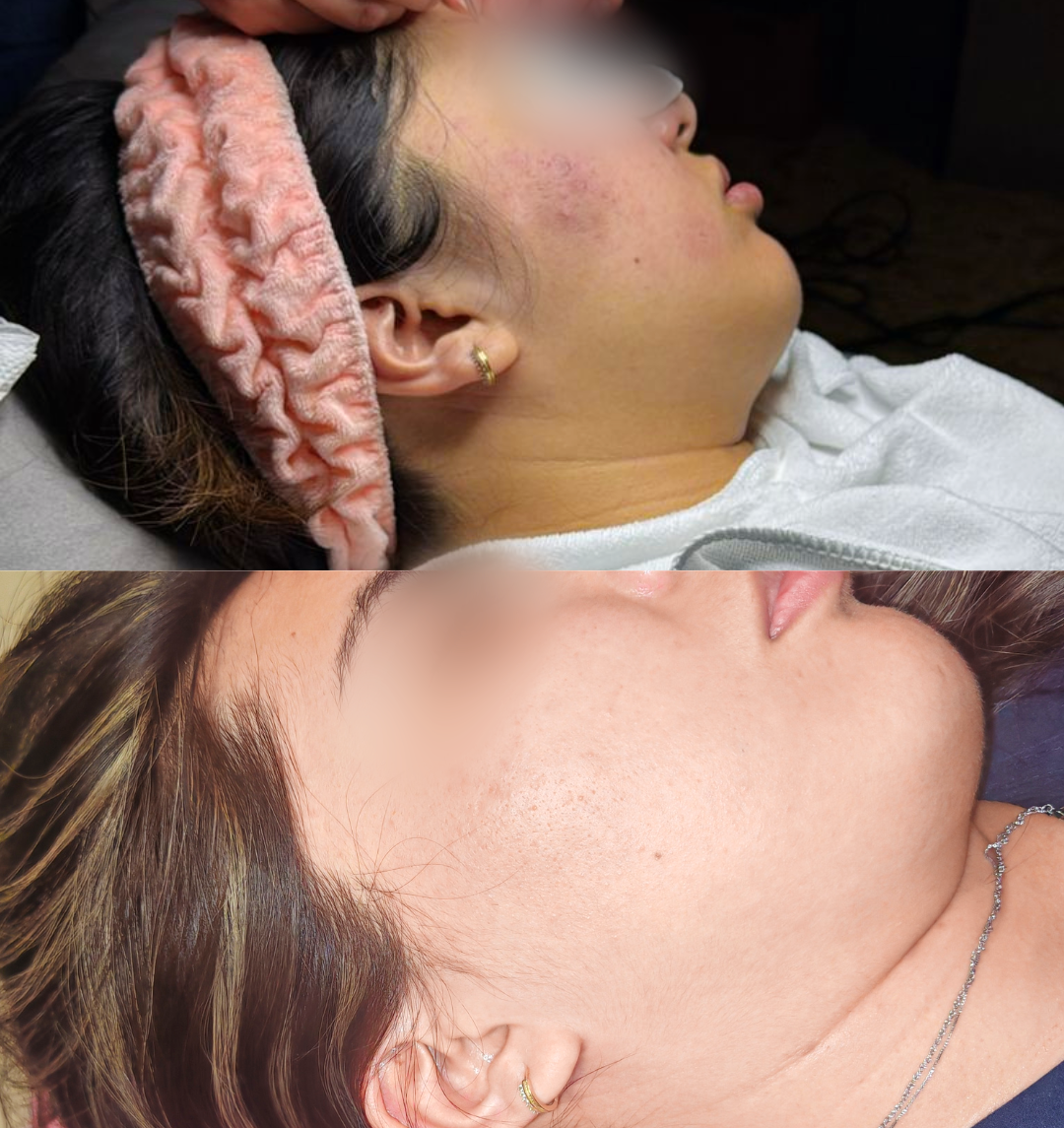 Proceso de cuidado facial durante tratamiento en Shen Balance